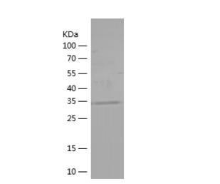 Recombinant Human ATXN2.png