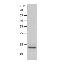 Recombinant Human B2M.png