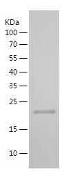 Recombinant Human CDKN2A.jpg