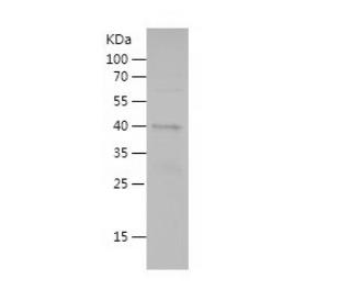 Recombinant Human galectin 9.png