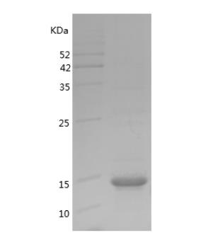 Recombinant Human GSK3B.png
