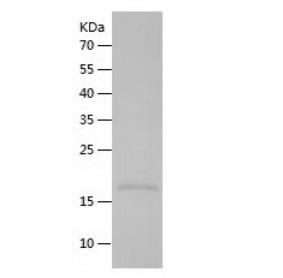Recombinant Human LECT2.png