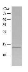 Recombinant Human MAP1LC3B2.jpg