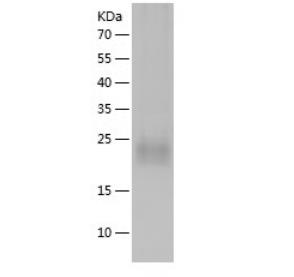 Recombinant Human M-CSF.png