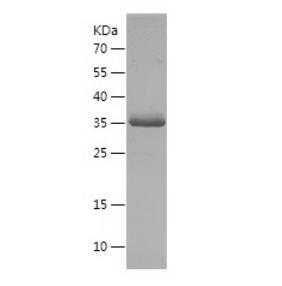 Recombinant Human PDCD5.png