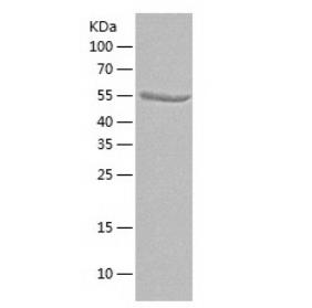 Recombinant Human PDGFR beta.png
