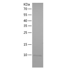 Recombinant Human PRKCH.png