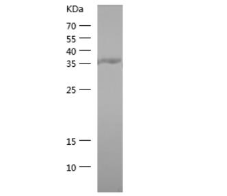 Recombinant Human PTP1B.png
