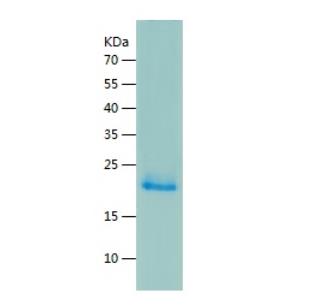 Recombinant Human RANKL.png
