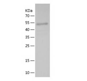 Recombinant Human TGFB1.png