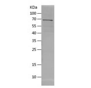 Recombinant Human AADAC.png