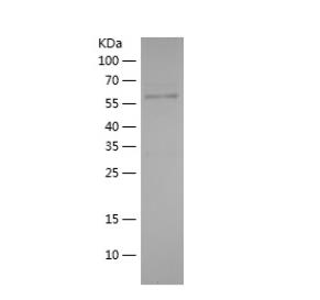 Recombinant Human ABCF2.png
