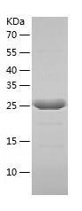 Recombinant Human ABHD10.jpg
