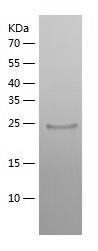 Recombinant Human ABHD14B.jpg