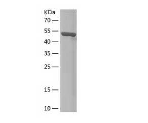 Recombinant Human ACAA1.png