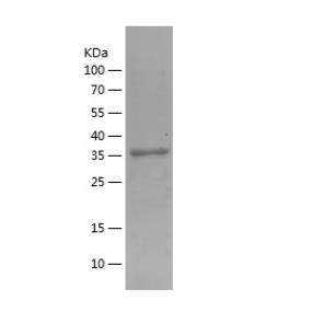 Recombinant Human ACAT1.png