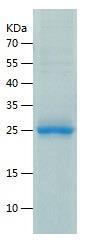 Recombinant Human ACSM3.jpg