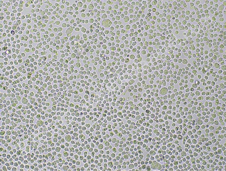 人结肠癌细胞；COLO205（STR）