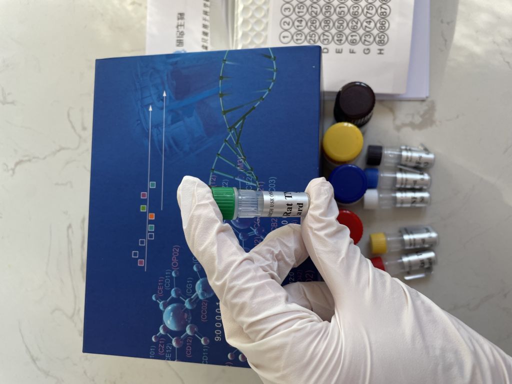 人网膜素1(Omentin-1）ELISA试剂盒