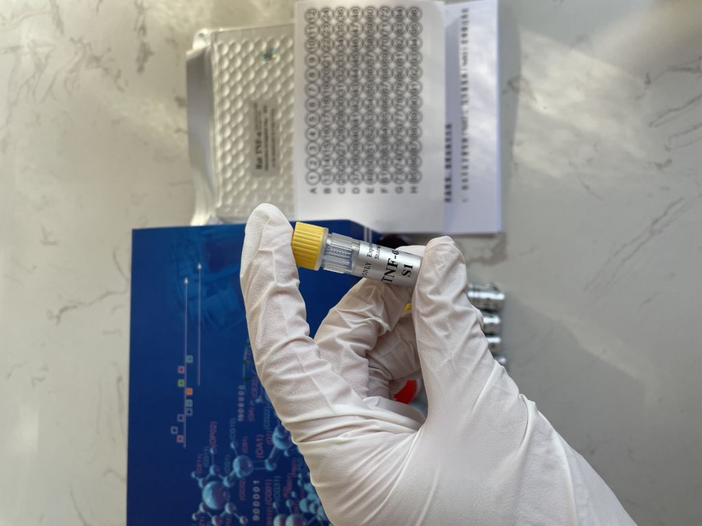 人细胞色素P4501A2(CYP1A2）ELISA试剂盒