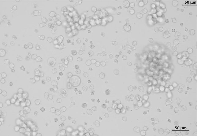 小鼠腺癌细胞系；F56（STR）
