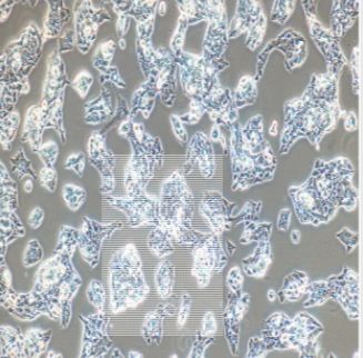 人胆囊癌细胞；GBCSD（STR）