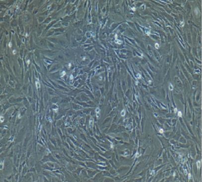 人整合SV40基因的乳腺上皮细胞；HBL100（STR）