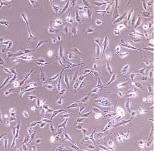 人子宫鳞癌细胞(高分化)HCC94
