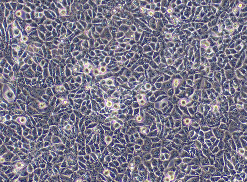 人脑微血管内皮细胞；HCMECD3