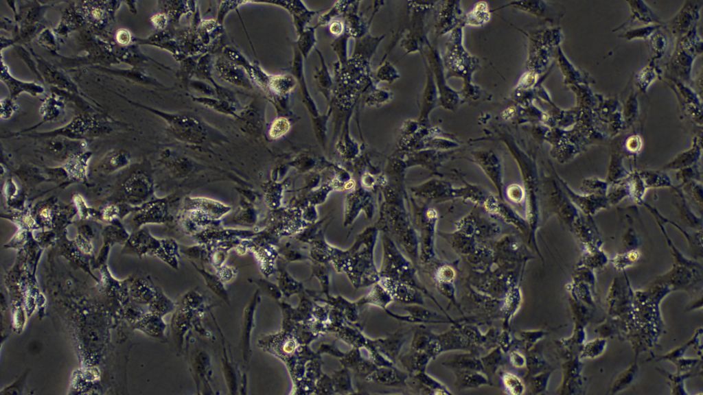 人结直肠癌癌细胞；HCT8（STR）