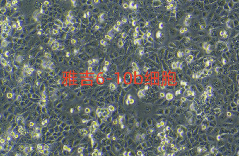 人肝癌细胞HepAD38（STR）