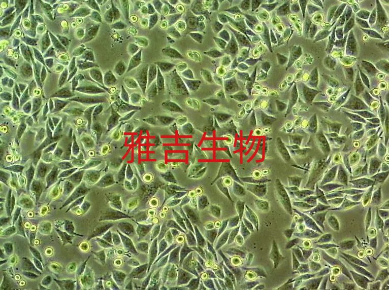 人肝癌细胞HepAD38（STR）