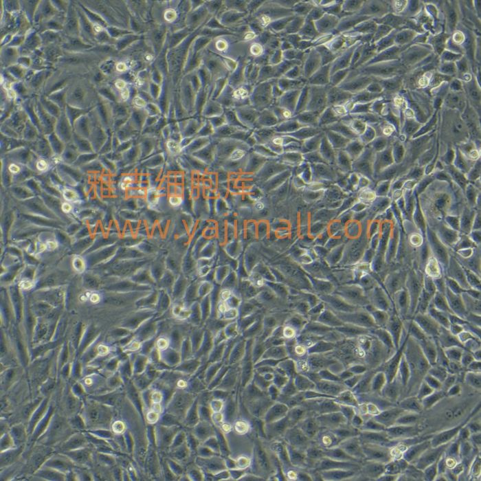 人肝癌细胞HepAD38（STR）