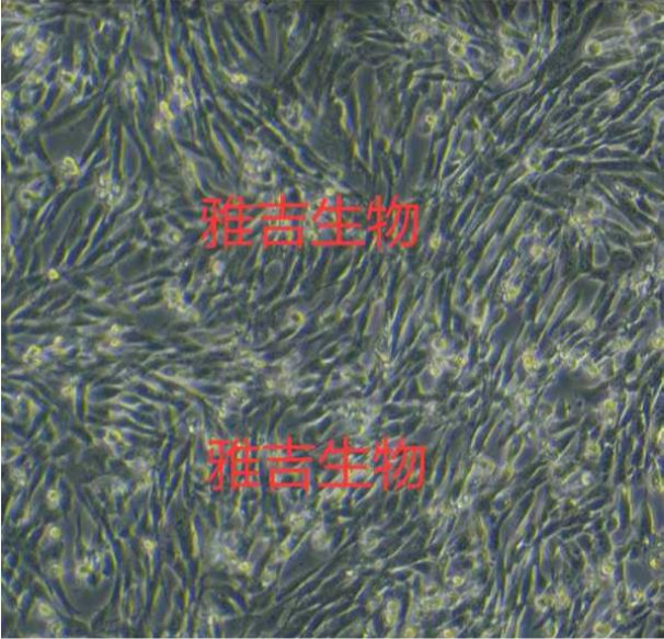 人肝癌细胞HepAD38（STR）