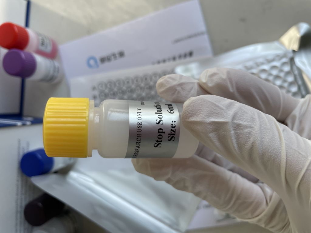 人血栓调节蛋白(TM）ELISA试剂盒