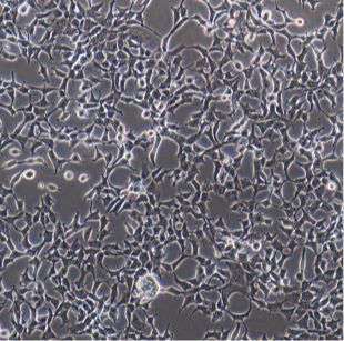 人高转移卵巢癌细胞HO8910PM（STR）