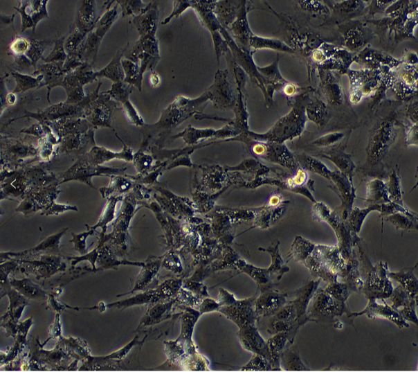 人膀胱癌细胞；HT1376