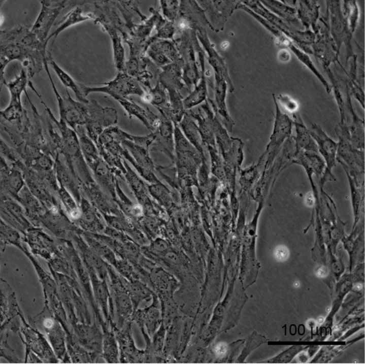 人膀胱癌细胞；HT1376