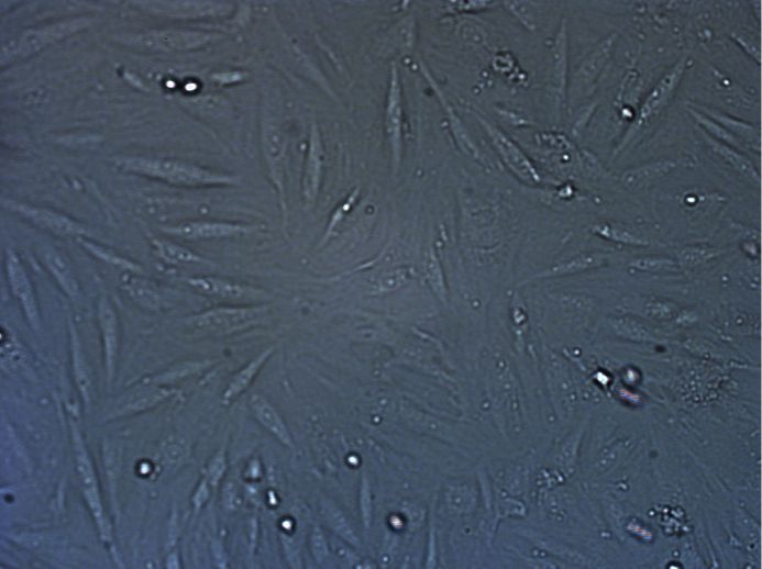 人肝内胆管癌细胞HuCCT1