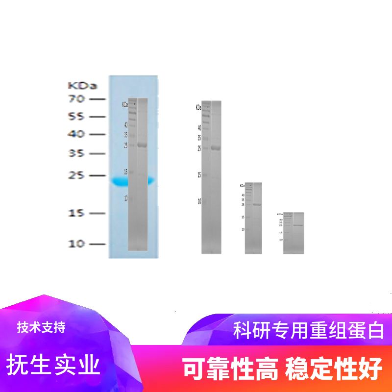 Recombinant Human Carbonic Anhydrase 8