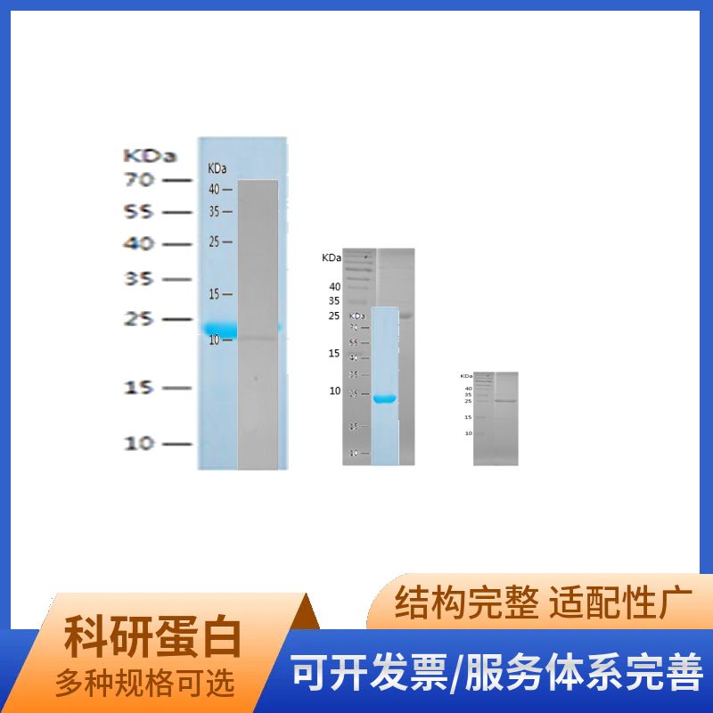 Recombinant Human ADO