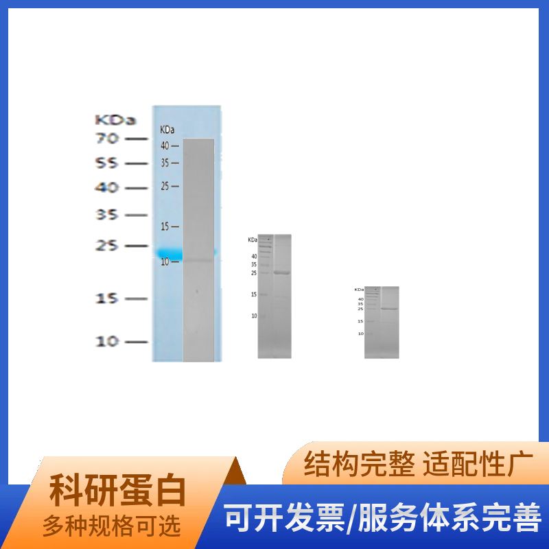 Recombinant Human ARL5B