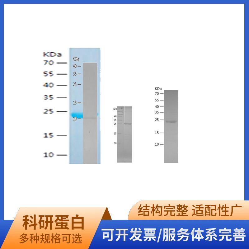 Recombinant Human BLK