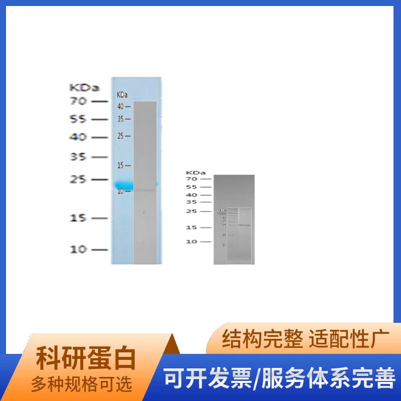 Recombinant Human ALKBH2