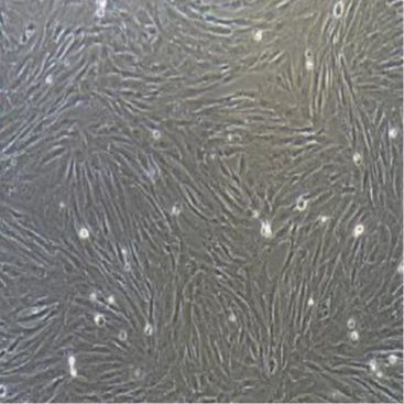 人急性T细胞白血病细胞；J.gamma1