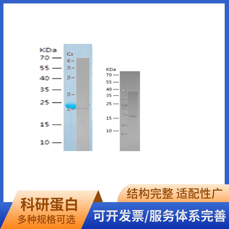 Recombinant Human BDH1