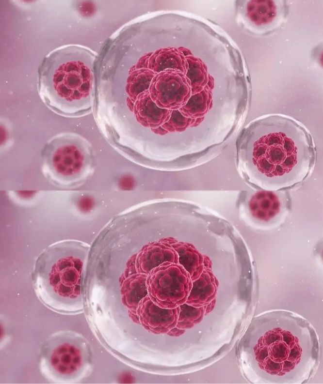 人急性原粒细胞白血病细胞KASUMI-1