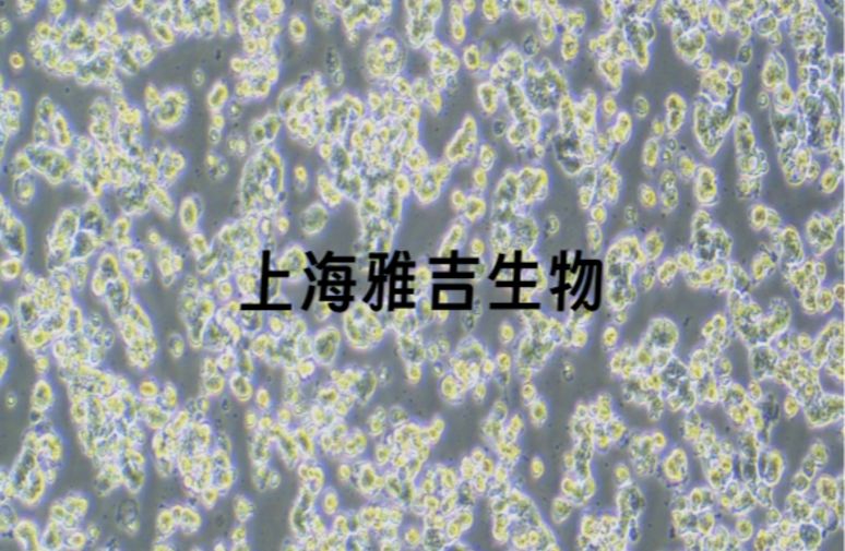 人卵巢颗粒细胞瘤细胞KGN（STR）