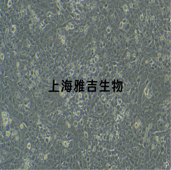 人子宫内膜癌细胞KLE（STR）