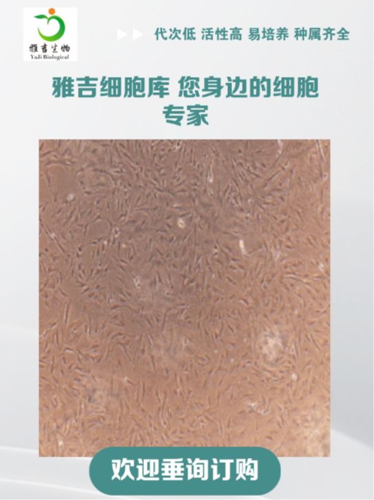 人脑胶质细胞瘤细胞KNS89（STR）